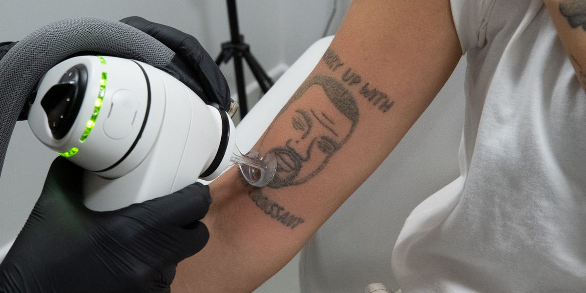 'Yeezy come, Yeezy go': Kanye West tattoos are being removed for free by a studio in London